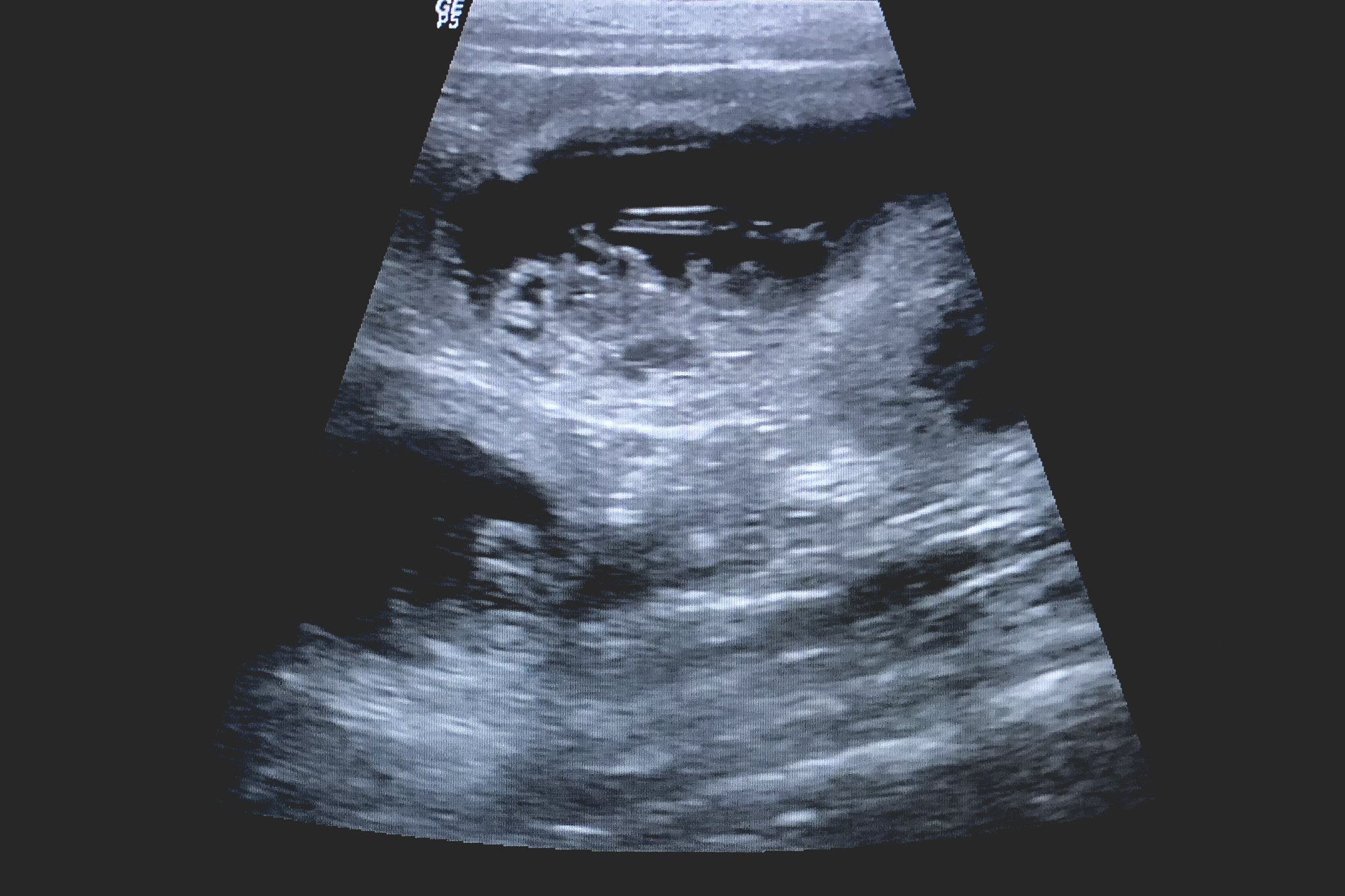 Ultraschallbild einer trächtigen Border Collie Hündin