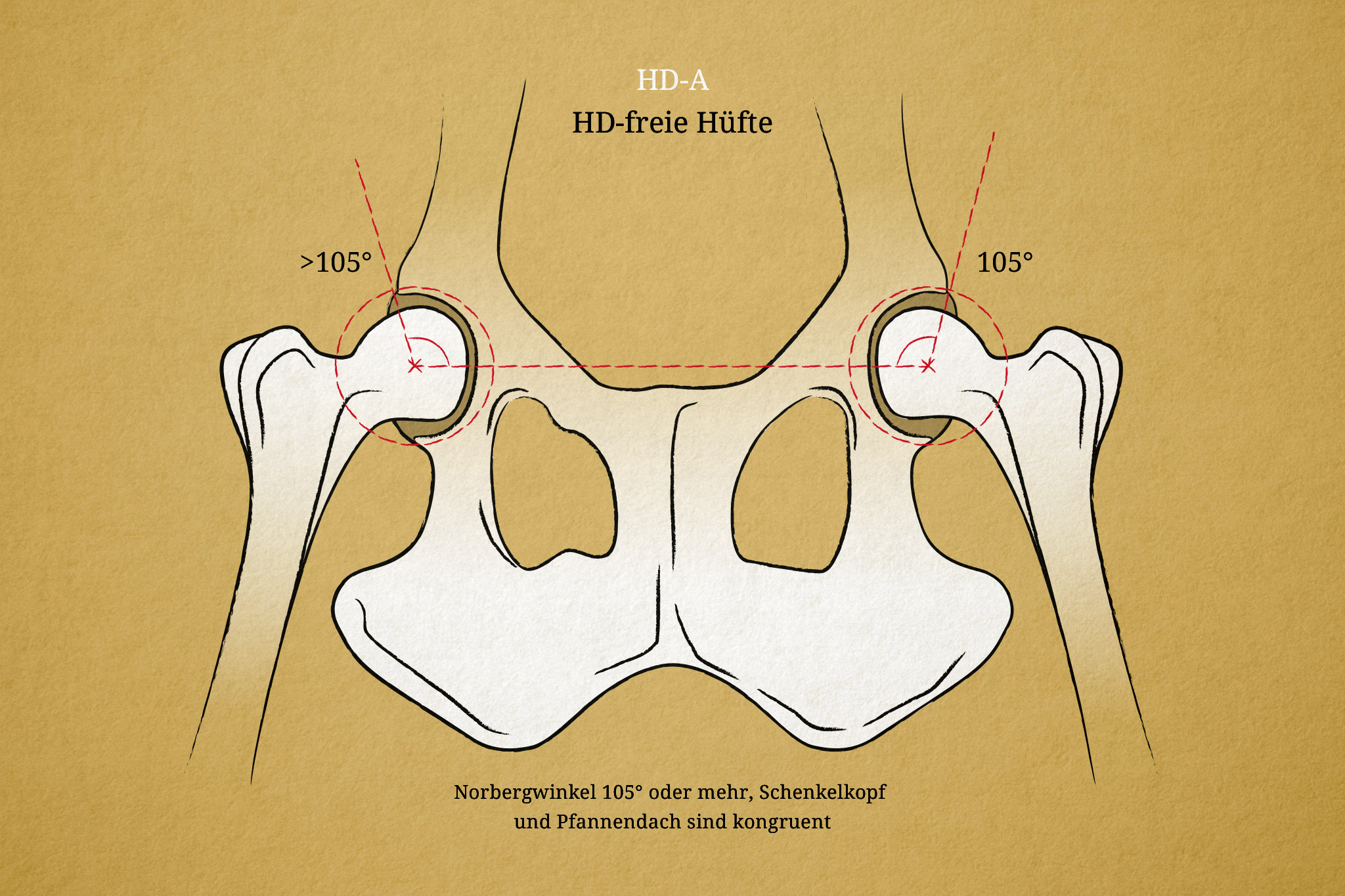 Hüftgelenksdysplasie Hund Illustration, HD-A, Norbergwinkel
