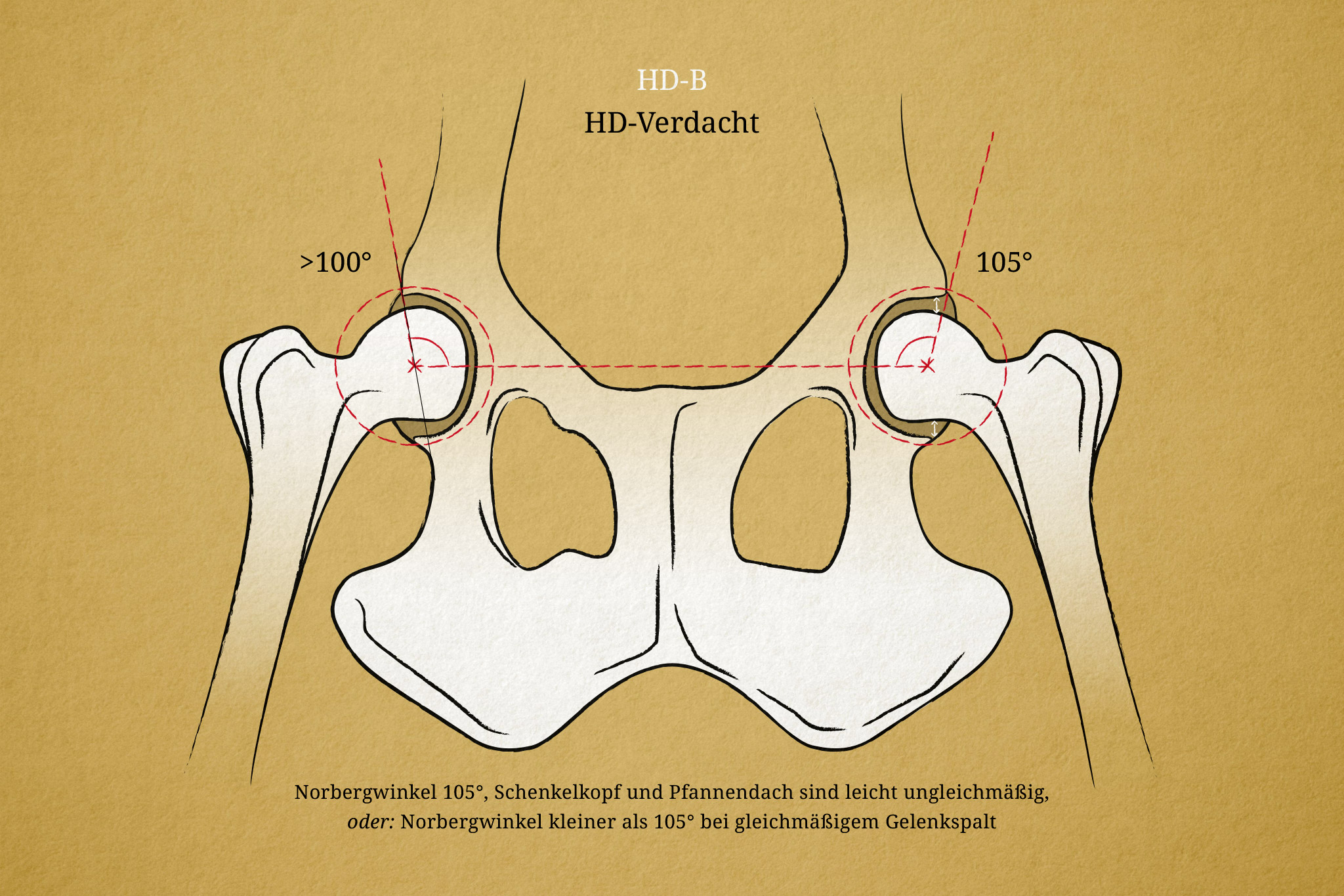 Hüftgelenksdysplasie Hund Illustration, HD-B, Norbergwinkel